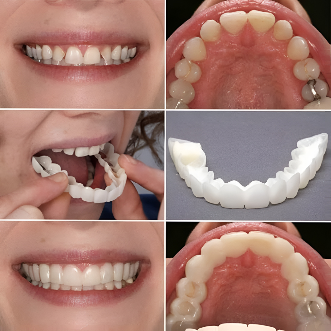 Teeth Veneers Smile Cover Snap Fit Cosmetic Caps