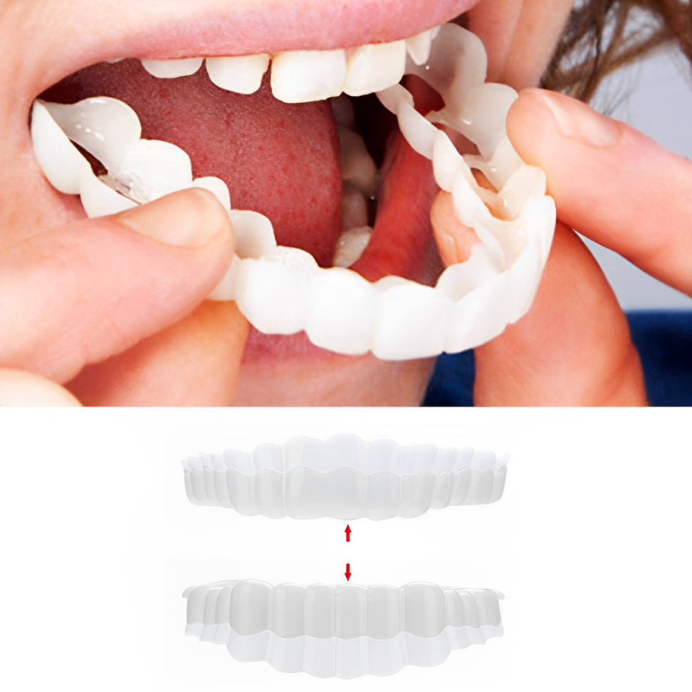 Aufsteckbare Veneers Natürliche Aussehende Künstliche Zähne
