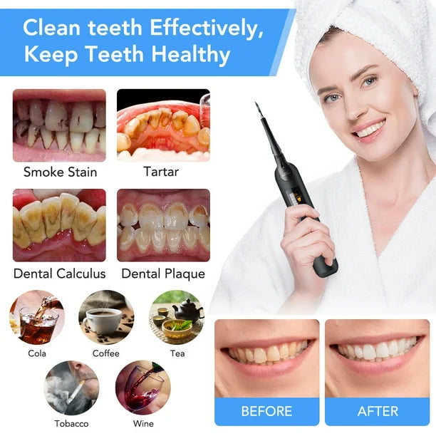 Teeth Cleaner | Waterproof Electric Scaler Tool for Home