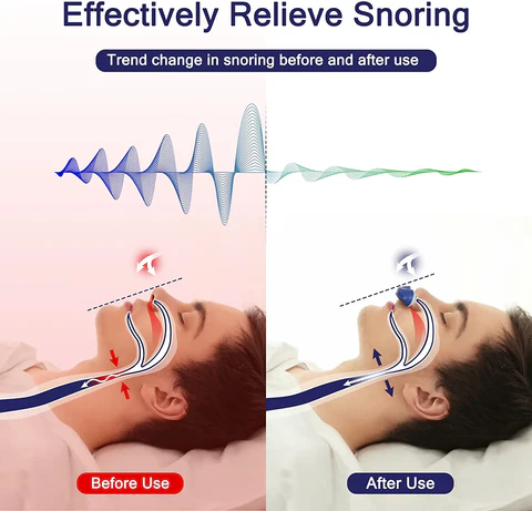 Anti Snoring Nose Clip for Better Sleep