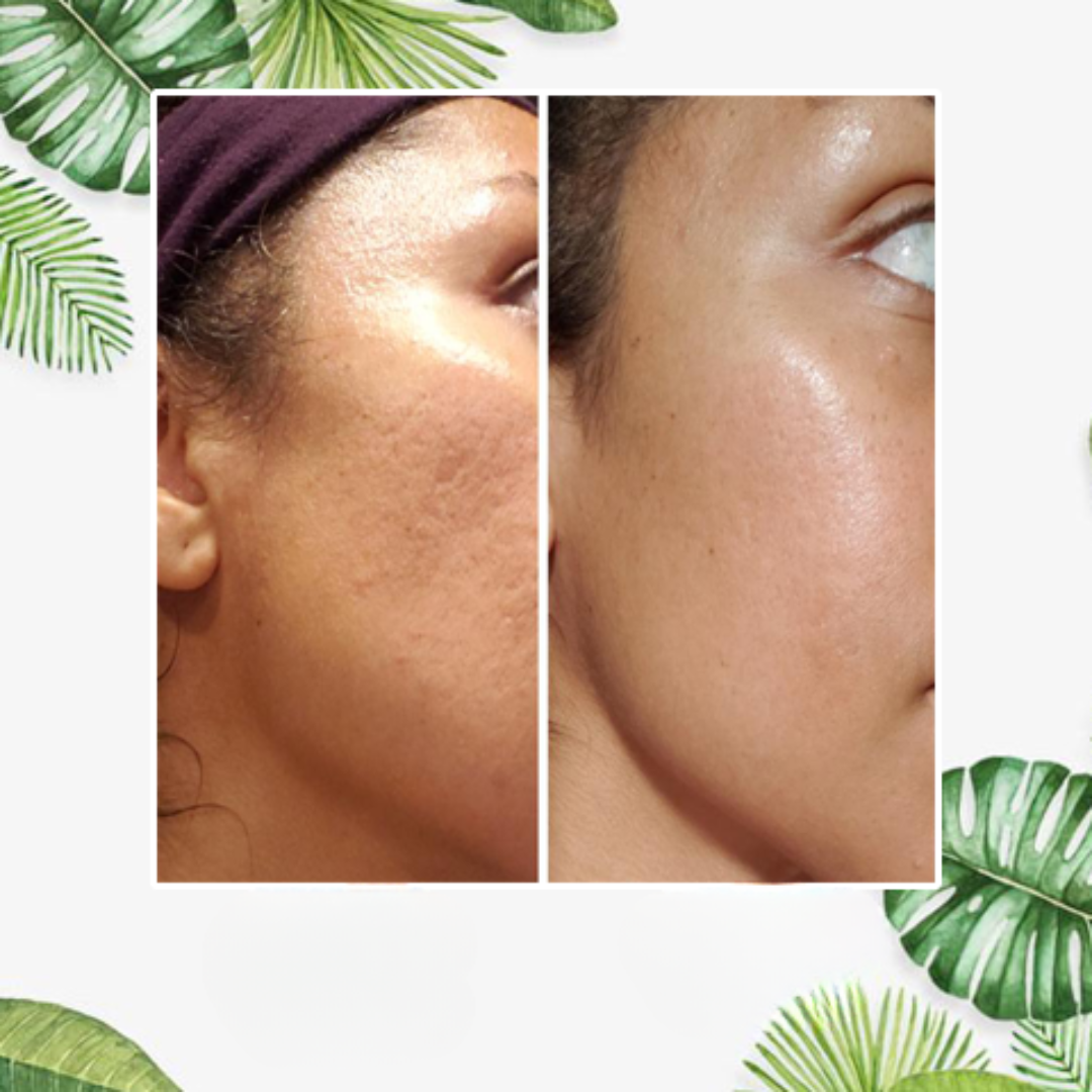 Stick Maschera Viso per Pelle Grassa Detox