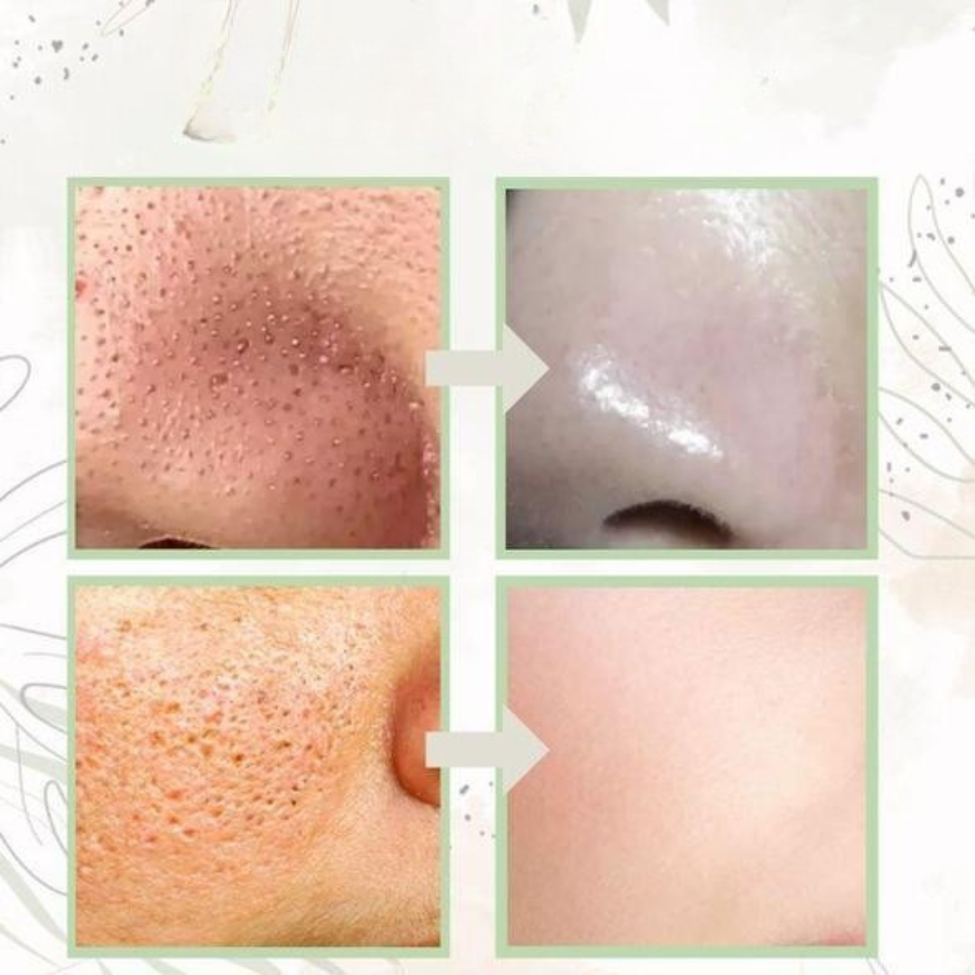 Stick Maschera Viso per Pelle Grassa Detox