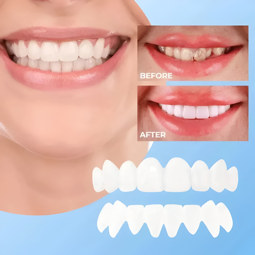 Teeth Veneers Smile Cover Snap Fit Cosmetic Caps