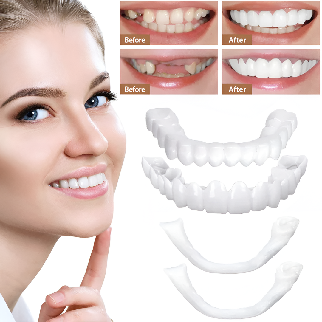 Teeth Veneers Smile Cover Snap Fit Cosmetic Caps