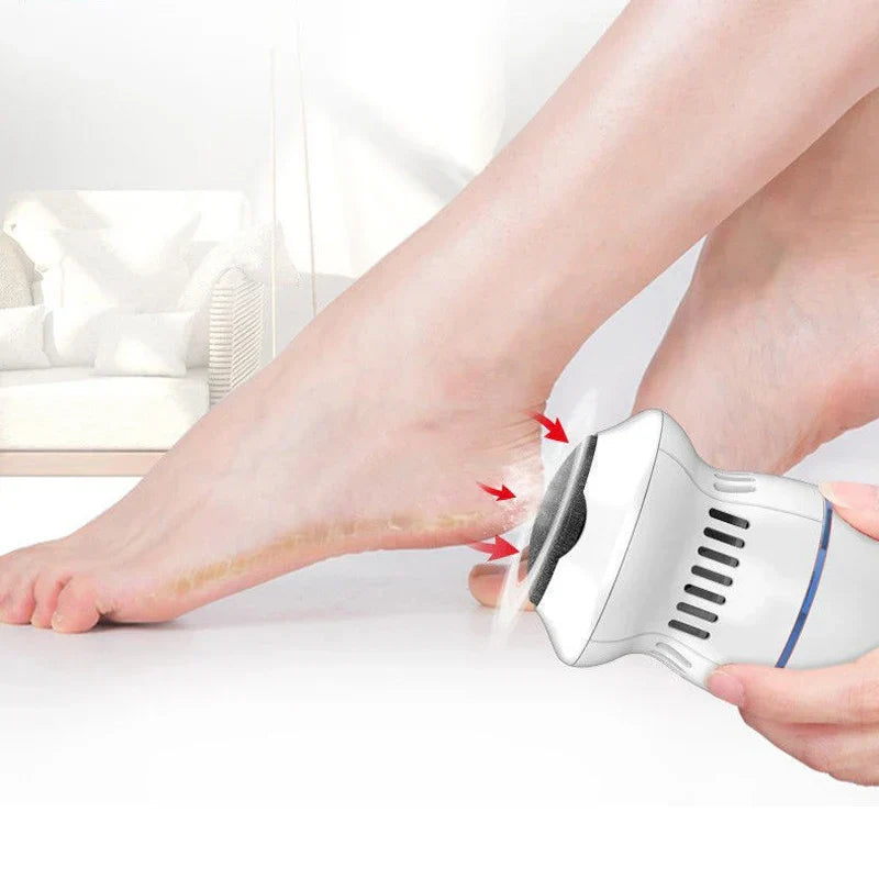 gentle-electric-foot-care-devi-1-ao6u8n
