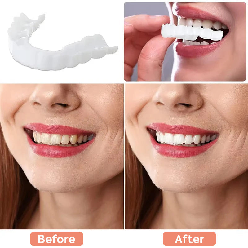 instant-smile-enhancer-clipon--7-3d3a2i
